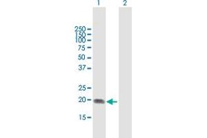 Western Blot analysis of ST6GAL1 expression in transfected 293T cell line by ST6GAL1 MaxPab polyclonal antibody. (ST6GAL1 anticorps  (AA 1-175))