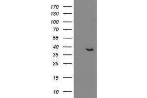 Western Blotting (WB) image for anti-DnaJ (Hsp40) Homolog, Subfamily B, Member 1 (DNAJB1) antibody (ABIN1498736) (DNAJB1 anticorps)