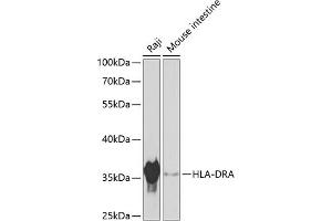 Western blot analysis of extracts of various cell lines, using HLA-DRA antibody (ABIN6131758, ABIN6141828, ABIN6141830 and ABIN6215479) at 1:1000 dilution. (HLA-DRA anticorps  (AA 26-216))