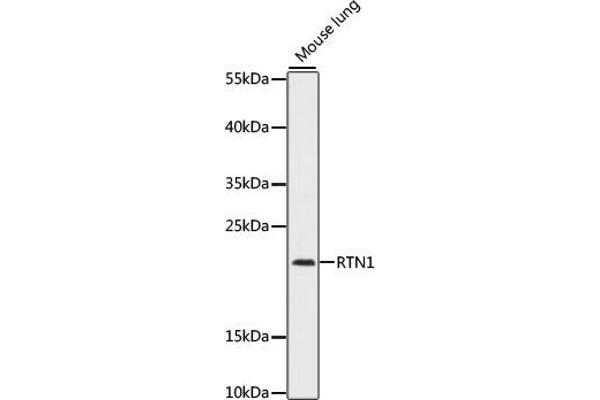 Reticulon 1 anticorps  (AA 80-340)