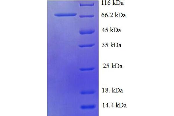 HARS2 Protein (AA 34-506) (His-SUMO Tag)