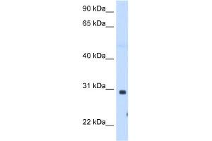WB Suggested Anti-ST3GAL3 Antibody Titration:  1. (ST3GAL3 anticorps  (C-Term))