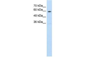 WB Suggested Anti-SLC11A1 Antibody Titration:  1. (SLC11A1 anticorps  (C-Term))