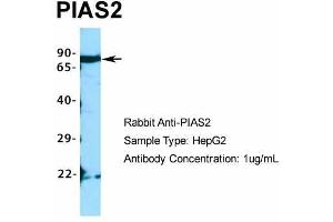 Host:  Rabbit  Target Name:  PIAS2  Sample Type:  HepG2  Antibody Dilution:  1. (PIAS2 anticorps  (C-Term))