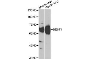 Western blot analysis of extracts of various cell lines, using BEST1 antibody (ABIN6290112) at 1:1000 dilution. (Bestrophin 1 anticorps)