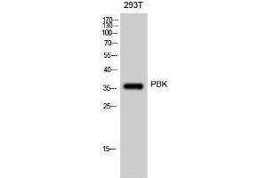 Western Blotting (WB) image for anti-PDZ Binding Kinase (PBK) (Tyr685), (Tyr753) antibody (ABIN3176791) (PBK anticorps  (Tyr685, Tyr753))