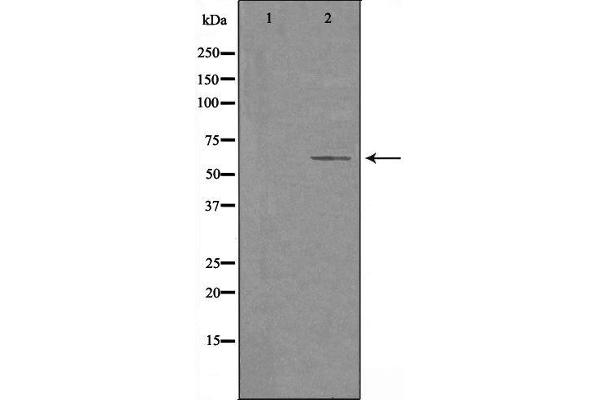 CYP2U1 anticorps  (Internal Region)