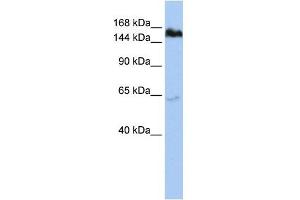 TNKS antibody used at 1 ug/ml to detect target protein. (TNKS anticorps  (Middle Region))