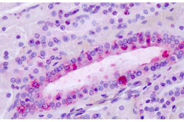 LPHN3 anticorps  (C-Term)