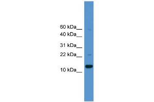 WB Suggested Anti-CASP1 Antibody Titration: 0. (Caspase 1 anticorps  (Middle Region))