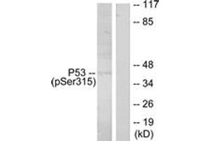 Western blot analysis of extracts from ovary cancer, using p53 (Phospho-Ser315) Antibody. (p53 anticorps  (pSer315))