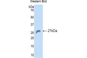 Detection of Recombinant HSPA5, Mouse using Polyclonal Antibody to Heat Shock 70 kDa Protein 5 (HSPA5) (GRP78 anticorps  (AA 261-470))