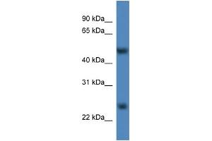 WB Suggested Anti-Mettl4 Antibody Titration:  0. (METTL4 anticorps  (C-Term))