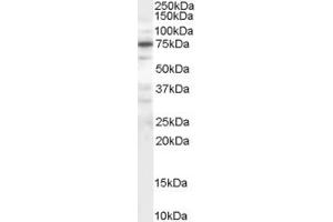 Western Blotting (WB) image for anti-Protein Phosphatase 1, Regulatory (Inhibitor) Subunit 15A (PPP1R15A) (AA 664-674) antibody (ABIN291973) (GADD34 anticorps  (AA 664-674))