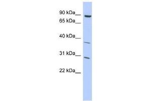 KLHL5 antibody used at 2. (KLHL5 anticorps  (Middle Region))