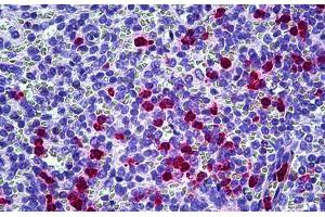 Anti-CAMP antibody IHC staining of human spleen, neutrophils. (Cathelicidin anticorps)