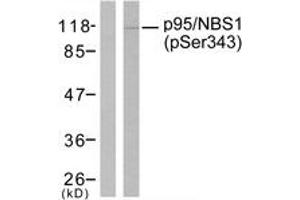 Western Blotting (WB) image for anti-Nibrin (NBN) (pSer343) antibody (ABIN2888479) (Nibrin anticorps  (pSer343))