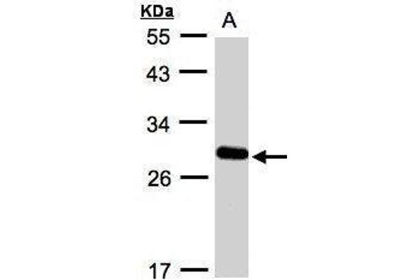 YIPF4 anticorps