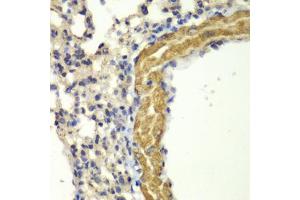 Immunohistochemistry of paraffin-embedded mouse lung using PRKG1 antibody (ABIN5971390) at dilution of 1/100 (40x lens). (PRKG1 anticorps)