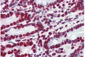 Human Small Intestine (formalin-fixed, paraffin-embedded) stained with HMGA1 antibody ABIN364402 at 4 ug/ml followed by biotinylated anti-goat IgG secondary antibody ABIN481715, alkaline phosphatase-streptavidin and chromogen. (HMGA1 anticorps  (AA 12-23))