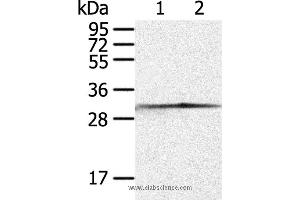 Western blot analysis of Jurkat and 293T cell, using CASP3 Polyclonal Antibody at dilution of 1:300 (Caspase 3 anticorps)