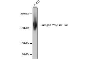 Western blot analysis of extracts of A-431 cells, using Collagen XVII/COL17 Rabbit mAb (ABIN7266467) at 1:1000 dilution. (COL17A1 anticorps)