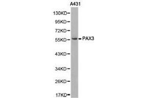 Western Blotting (WB) image for anti-Paired Box 3 (PAX3) antibody (ABIN1874047) (Paired Box 3 anticorps)