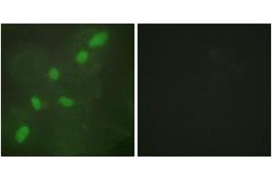 Immunofluorescence analysis of HeLa cells, using hnRNP A2/B1 Antibody. (HNRNPA2B1 anticorps  (AA 1-50))