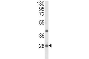 Western blot analysis of EIF4E2 antibody and NCI-H460 lysate. (EIF4E2 anticorps)