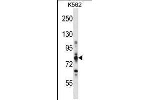 Western blot analysis in K562 cell line lysates (35ug/lane). (CPT1A anticorps  (C-Term))