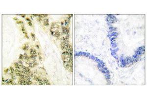 Immunohistochemistry (IHC) image for anti-Thyroid Hormone Receptor, alpha (THRA) (N-Term) antibody (ABIN1848805) (THRA anticorps  (N-Term))