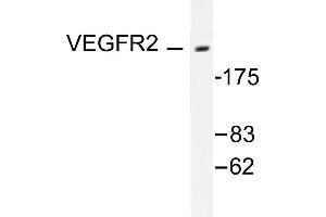 Image no. 1 for anti-VEGF Receptor 2 (VEGFR2) antibody (ABIN271861) (VEGFR2/CD309 anticorps)
