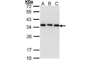WB Image Sample (30 ug of whole cell lysate) A: A431 , B: H1299 C: Hela 12% SDS PAGE antibody diluted at 1:1000 (TBCB anticorps)