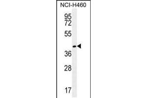Western blot analysis in NCI-H460 cell line lysates (35ug/lane). (GGH anticorps  (C-Term))
