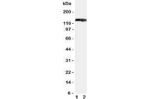 Western blot testing of COL2A1 antibody and Lane 1:  rat heart;  2: rat brain tissue lysate. (COL2A1 anticorps  (C-Term))