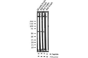 Western blot analysis of Phospho-Akt (Ser473) expression in various lysates (AKT1 anticorps  (pSer473))