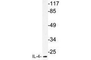 Western blot analysis of IL-4 antibody in extracts from MCF-7cells. (IL-4 anticorps)