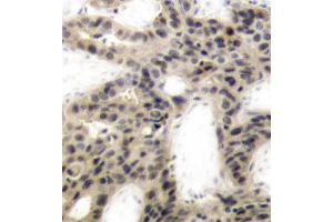 Immunohistochemistry (IHC) image for anti-Eukaryotic Translation Initiation Factor 4E Binding Protein 1 (EIF4EBP1) (pThr45) antibody (ABIN1870151) (eIF4EBP1 anticorps  (pThr45))