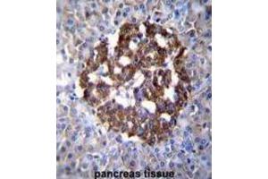 Immunohistochemistry (IHC) image for anti-Protocadherin 20 (PCDH20) antibody (ABIN2996299) (PCDH20 anticorps)