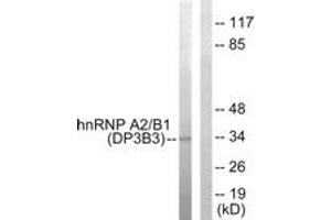 Western blot analysis of extracts from HepG2 cells, using hnRNP A2/B1 Antibody. (HNRNPA2B1 anticorps  (AA 1-50))