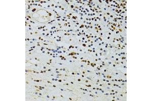 Immunohistochemistry of paraffin-embedded human vermiform appendix using ALYREF antibody (ABIN5973579) at dilution of 1/100 (40x lens). (THO Complex 4 anticorps)