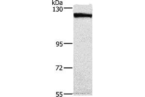 Western blot analysis of Human tongue cancer tissue, using DSG1 Polyclonal Antibody at dilution of 1:750 (Desmoglein 1 anticorps)