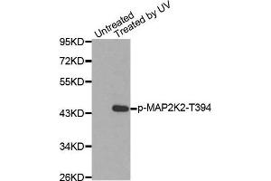 Western blot analysis of extracts from HepG2 cells using Phospho-MAP2K2-T394 antibody. (MEK2 anticorps  (pThr394))