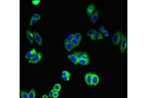 Immunofluorescent analysis of HepG2 cells using ABIN7146224 at dilution of 1:100 and Alexa Fluor 488-congugated AffiniPure Goat Anti-Rabbit IgG(H+L) (N-Cadherin anticorps  (AA 746-906))