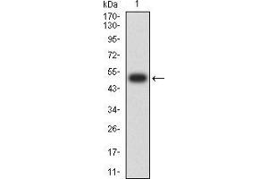 Western blot analysis using MIB1 mAb against human MIB1 (AA: 6-221) recombinant protein. (MIB1 anticorps  (AA 6-221))