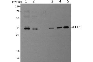 Image no. 1 for anti-Eukaryotic Translation Elongation Factor 1 beta 2 (EEF1B2) antibody (ABIN334557) (EEF1B2 anticorps)