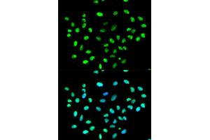 Immunofluorescence analysis of MCF-7 cells using HNRNPK antibody. (HNRNPK anticorps)