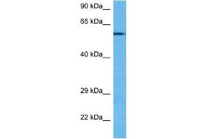 Host:  Rabbit  Target Name:  PPP3CA  Sample Tissue:  Mouse Heart  Antibody Dilution:  1ug/ml (PPP3CA anticorps  (N-Term))