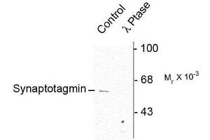 Image no. 1 for anti-Synaptotagmin I (SYT1) (pSer309) antibody (ABIN372725) (SYT1 anticorps  (pSer309))