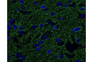 Indirect immunostaining of PFA fixed, paraffin embedded mouse brain (dilution 1 : 500; green). (Tubulin delta 2 (AA 443-449) anticorps)